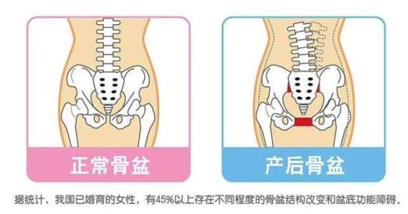 脱垂影响受孕吗,脱垂会影响月经吗