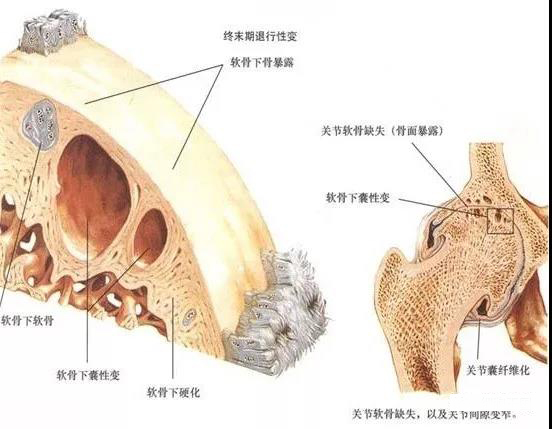 慢性疼痛药品治疗新进展,干细胞疗法治疗慢性疼痛