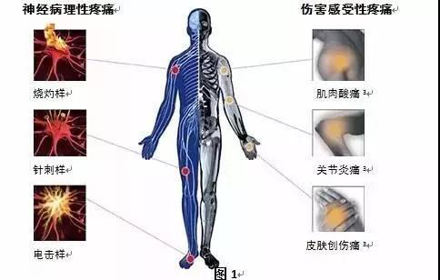 慢性疼痛药品治疗新进展,干细胞疗法治疗慢性疼痛