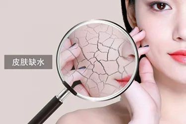 皮肤长痘是缺水引起的么,皮肤干燥缺水长斑用什么护肤品