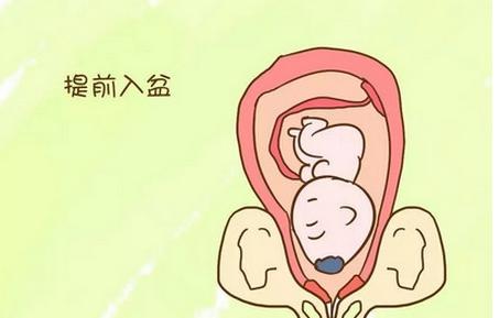 预产期临近，阵痛明显，胎儿不入盆怎么办？听听专家怎么说