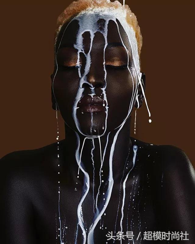 她连牙龈都是乌黑的！但她却敢反歧视，活成INS大热的模特女王