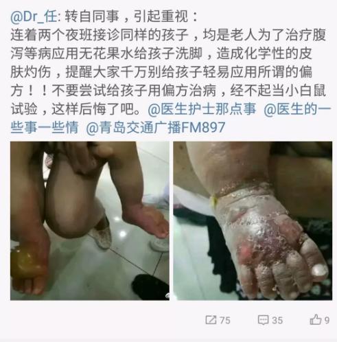 蝌蚪生吃偏方,小蝌蚪生吃是什么偏方