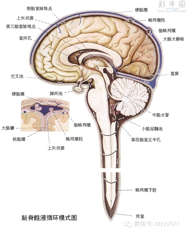幼儿脑积水首选术式,脑积水微创术是外引流吗