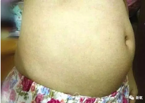 那些为了钱卖自己卵子的女生后来都怎样了？
