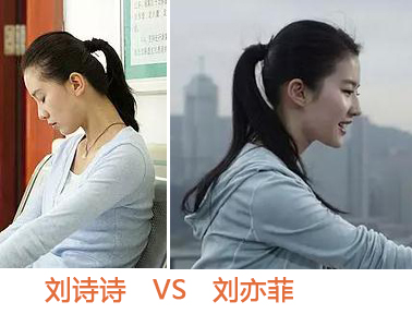 圆头扁头对颜值的影响,扁头对颜值的伤害