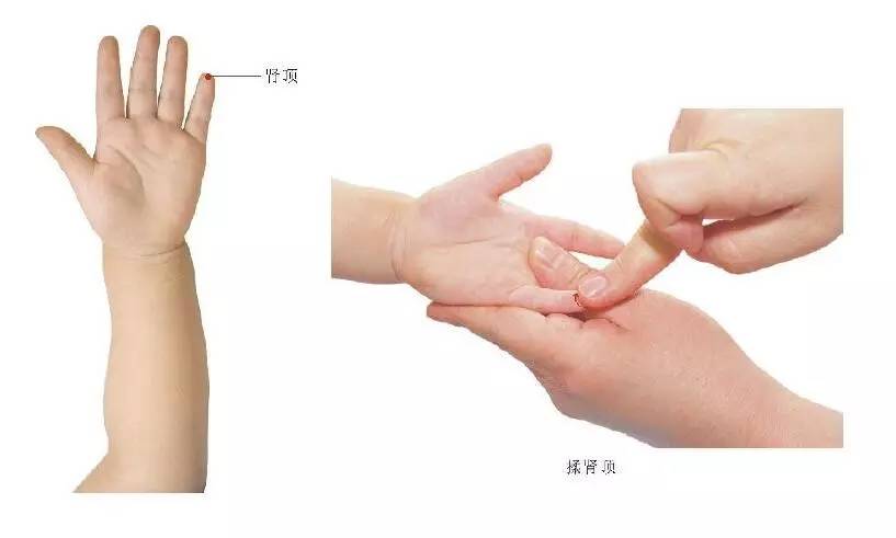 孩子盗汗要怎么调理,孩子盗汗的原因和治疗方法