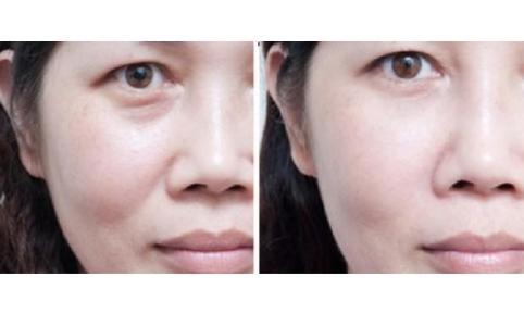 处女脸、果汁脸，你的老公鹿晗林更新们到底心水哪一款？