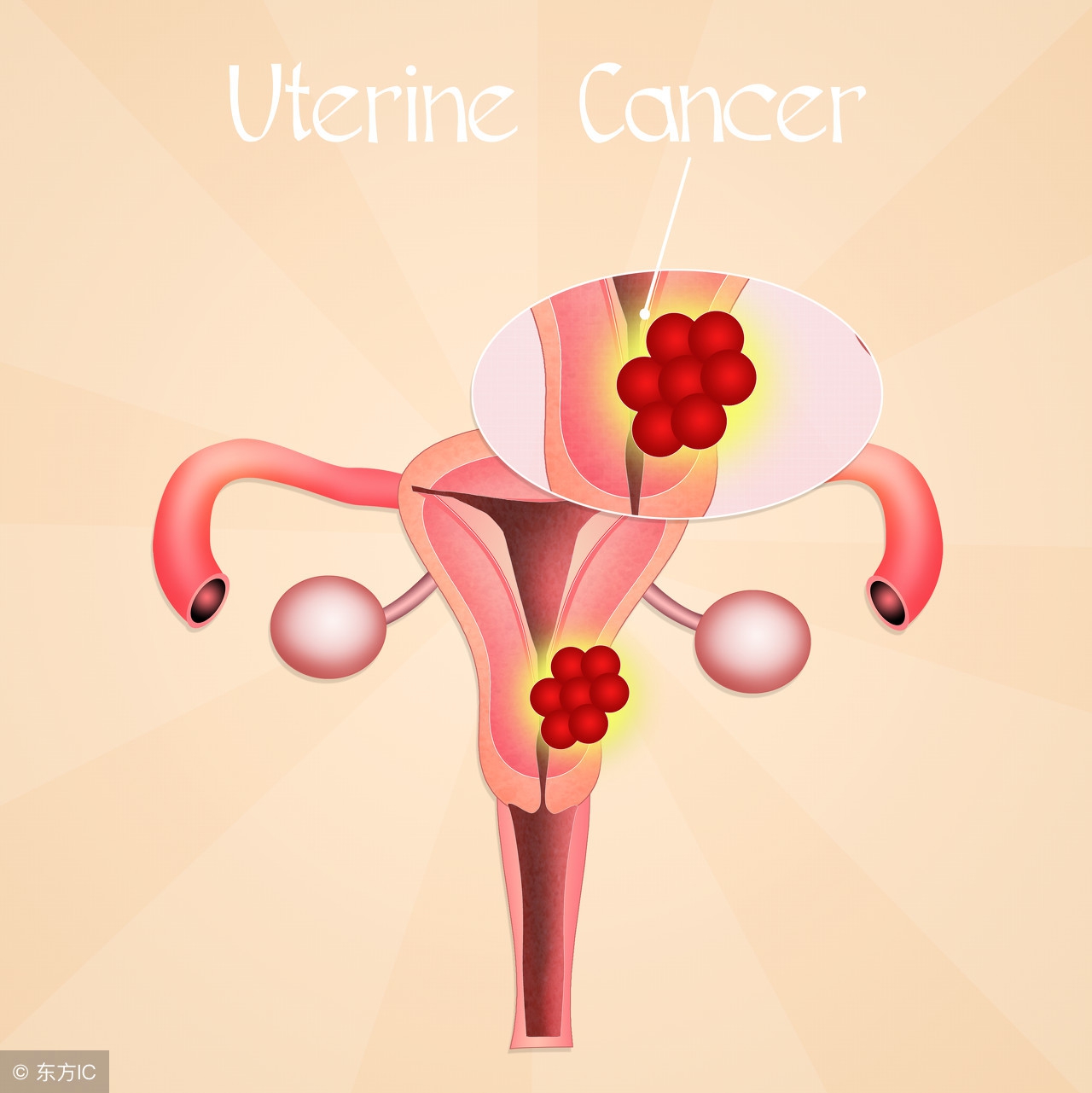 你的“大姨妈”是什么颜色？出现6种颜色要当心，可能是妇科疾病