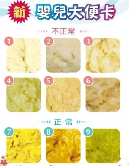 屎不成形还是暗黑色,便便不正常的颜色有哪些