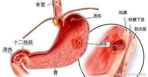 老年人遇到“消化不良”怎么办？找病因、减轻症状，胃口好才健康