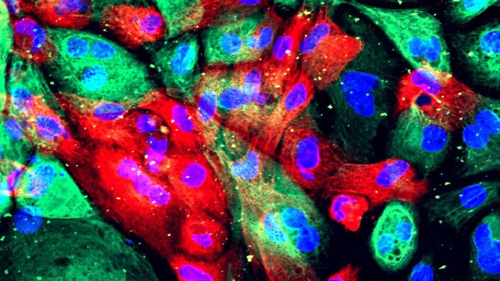 科学家发现癌症新突破,医学新发现癌症最新突破