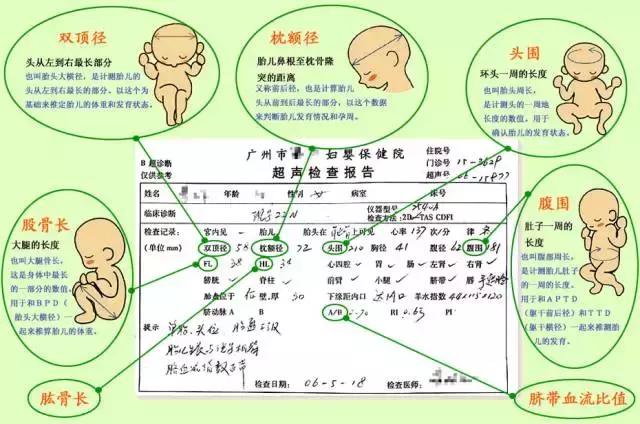 一分钟看懂产检报告,产检化验单报告单模板