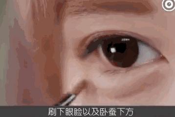 造成黑眼圈的常见原因,黑眼圈的形成原因与治疗