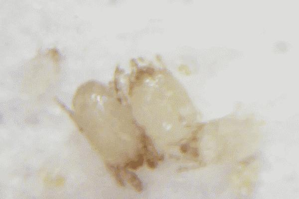床上螨虫的繁殖速度,床上螨虫用杀螨剂管用吗