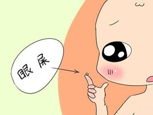 宝宝眼屎多是不是太上火了,宝宝眼屎太多是因为上火吗