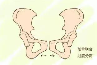 盘点孕晚期，4大不适症状，一个一个教你搞定！