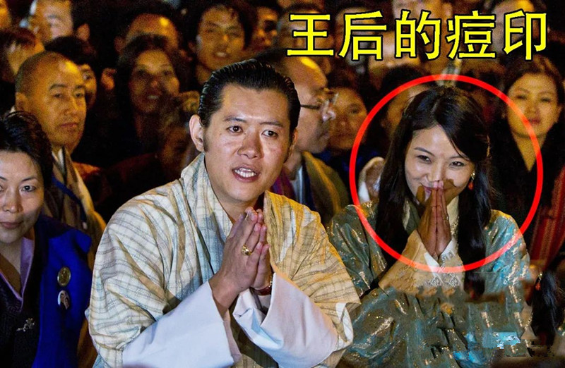 佩玛王后一颗“眉心痘”，不再面无表情冷冰冰，慈眉善目多了温柔