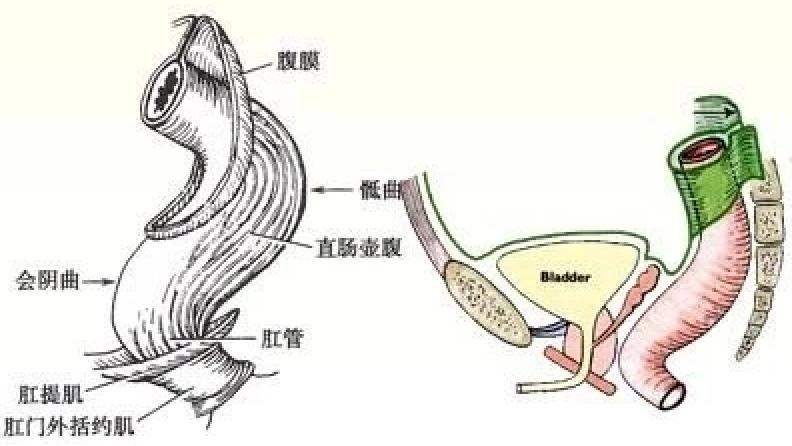 一条罗非鱼“游”进肛门？医生：直肠不直，进去容易出来难