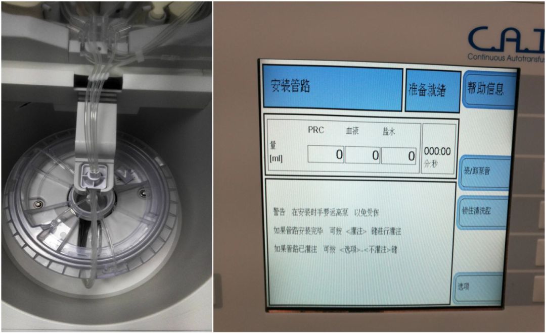 马康：术中自体血液回收