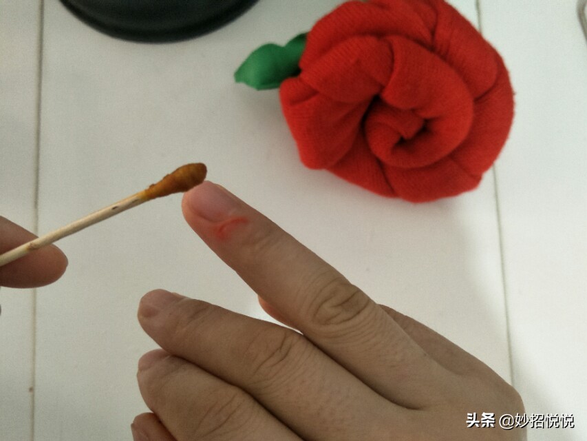 不小心划破了怎么避免留疤,被划伤用什么药愈合得快一点