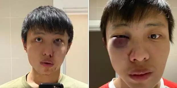 疫情华侨在国外被歧视,疫情海外华人的真实生活