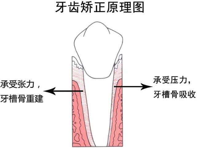 做牙齿矫正老了会不会容易掉牙,牙齿矫正以后年龄大了会先掉吗
