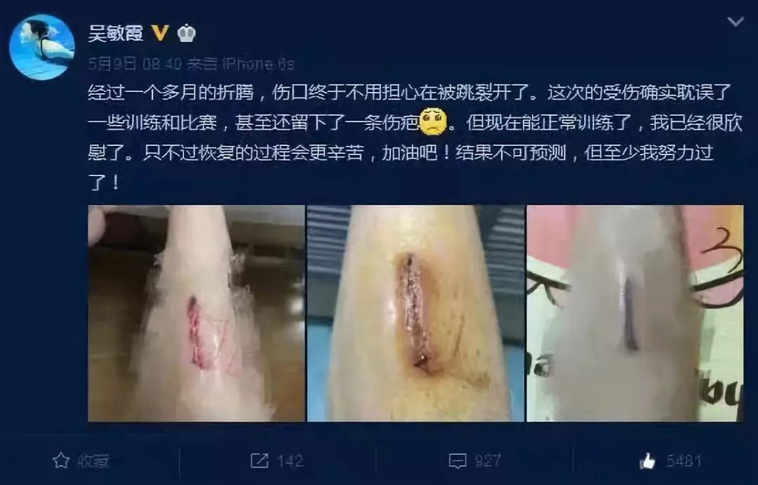 郭晶晶成功背后的心酸,郭晶晶的真实经历