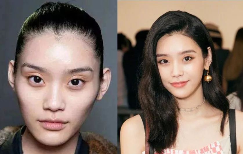 15天暴瘦20斤，却意外暴露了她填充过度的馒头脸