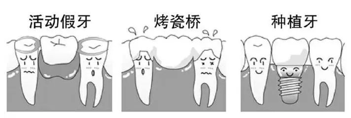 蛀牙疼是拔还是补,蛀牙痛还是拔智齿痛