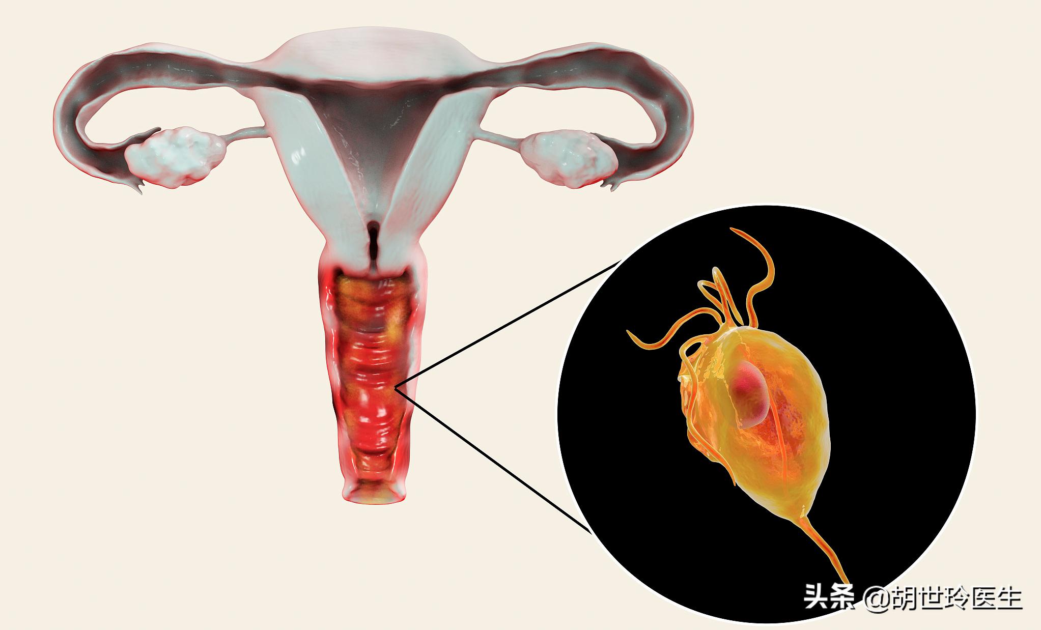 hpv妇科病有哪些症状,常见的妇科病有哪些症状