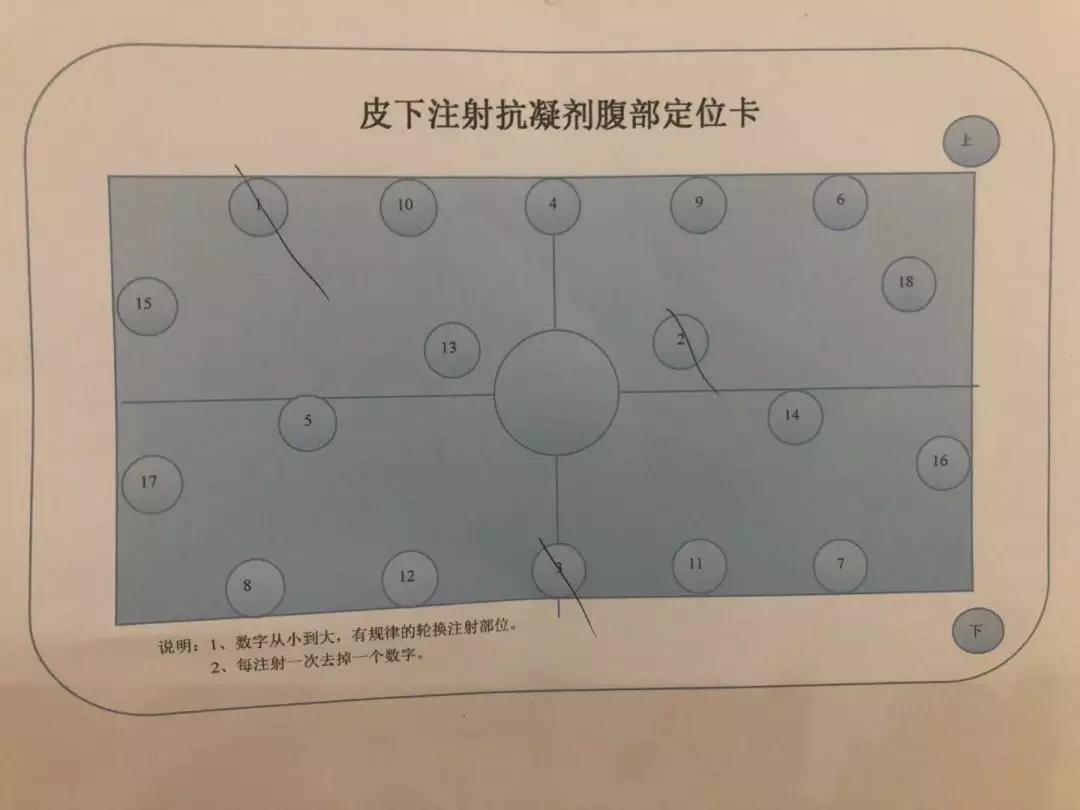 打肝素针打肚皮的时候进血了,打低分子肝素针怎么好扎