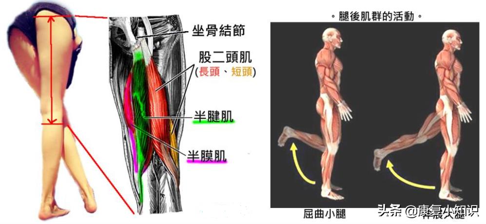 大腿后侧疼痛是癌症吗,大腿后侧疼痛有什么方法缓解