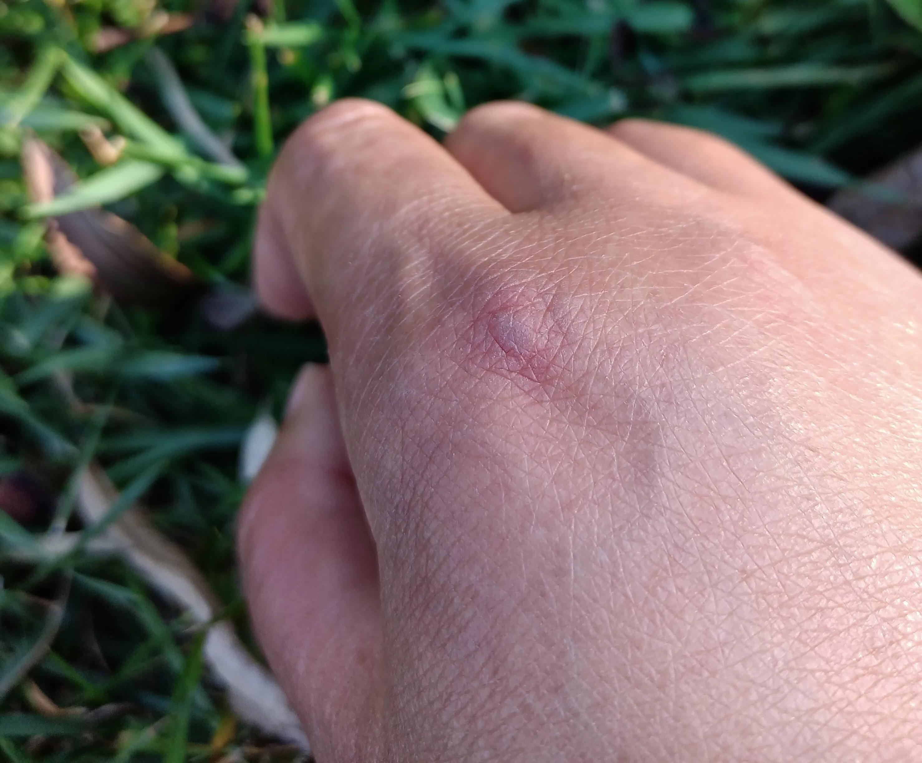 上香时被香灰烫了手是什么意思,上香时被香烫到手有什么寓意
