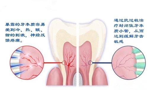 用于牙痛的消炎镇痛药有哪些,止痛药对牙痛有效吗