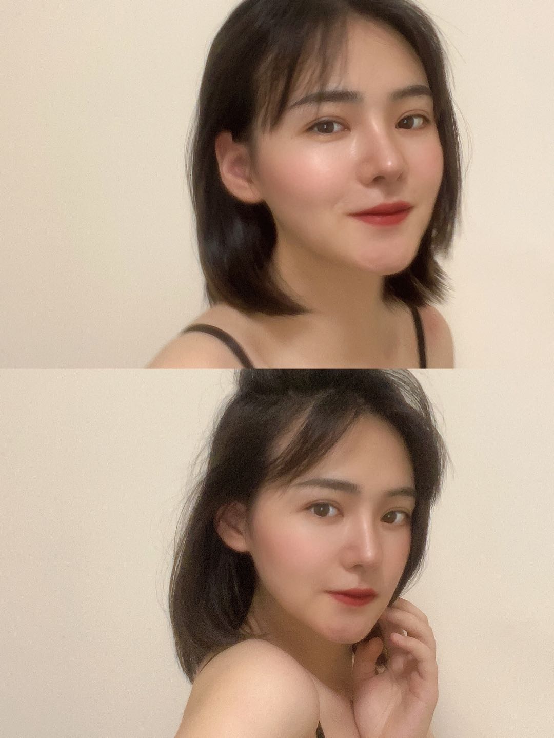 熬夜一晚鼻基底凹陷法令纹出来了,颧骨高鼻基底凹陷法令纹深怎么整