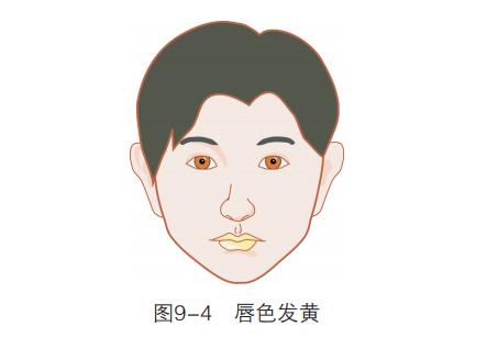 唇色异常有哪几种表现,唇色发白预示什么病症