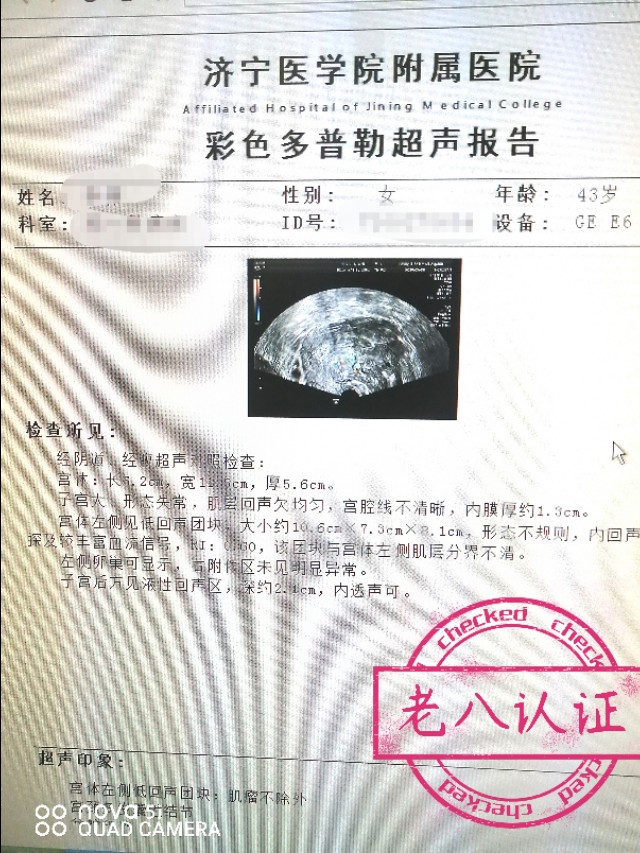 一个特殊子宫的“去与留”