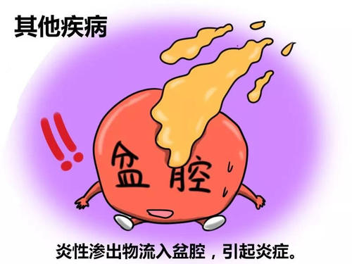 妇科频繁性出血什么原因,女生发生性出血是什么原因