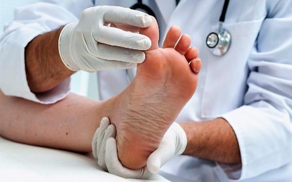 足癣可以泡海水吗,苦参加什么泡脚治足癣