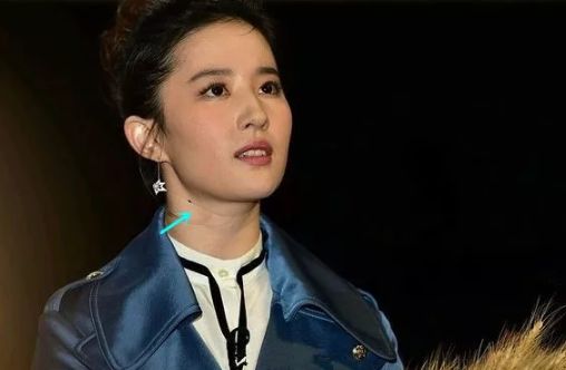明星如何祛颈纹,女生颈纹很深该怎么解决