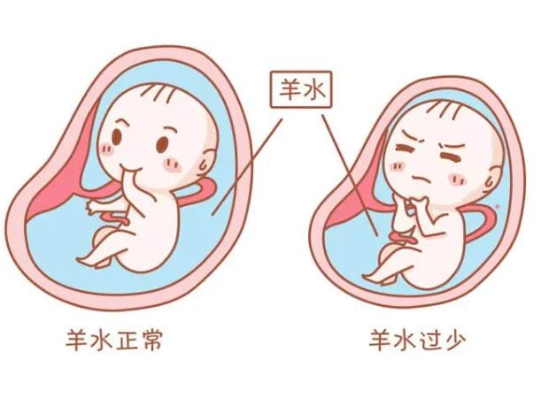 羊水少怎么办多喝椰子水,羊水多和喝椰青有关系吗