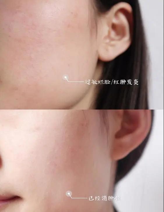 脸上有黄有斑还暗沉怎么办,皮肤暗黄有色斑怎样护肤