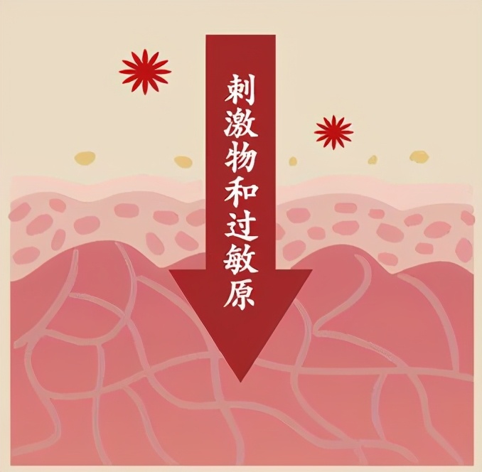 肛门湿疹反复痒，需要祛湿还是保湿，传染吗？