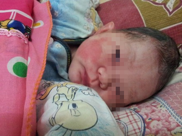 顺产宝宝的头为什么那么长,顺产小孩的头很长怎么办