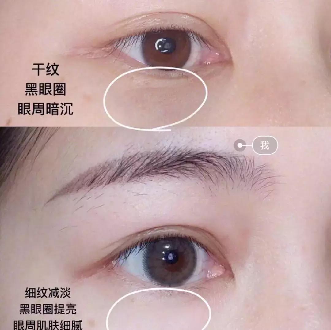 卖得最火爆的紧致眼霜,韩国卖爆了的化妆品