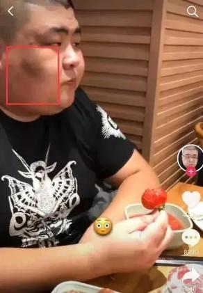 要红还是要命？吃播插入40厘米长管催吐，多人因暴饮暴食猝死