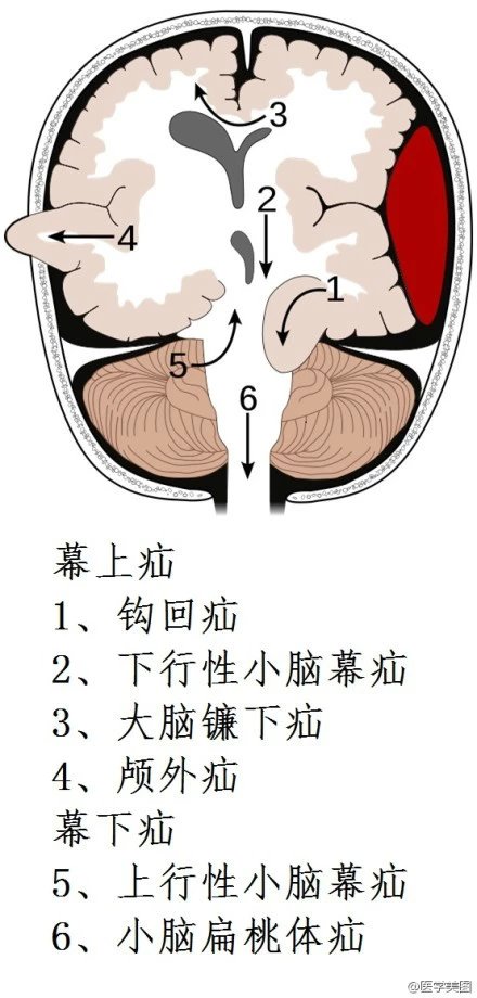 人体神经系统完整解剖图,超全神经系统解剖图近乎完美