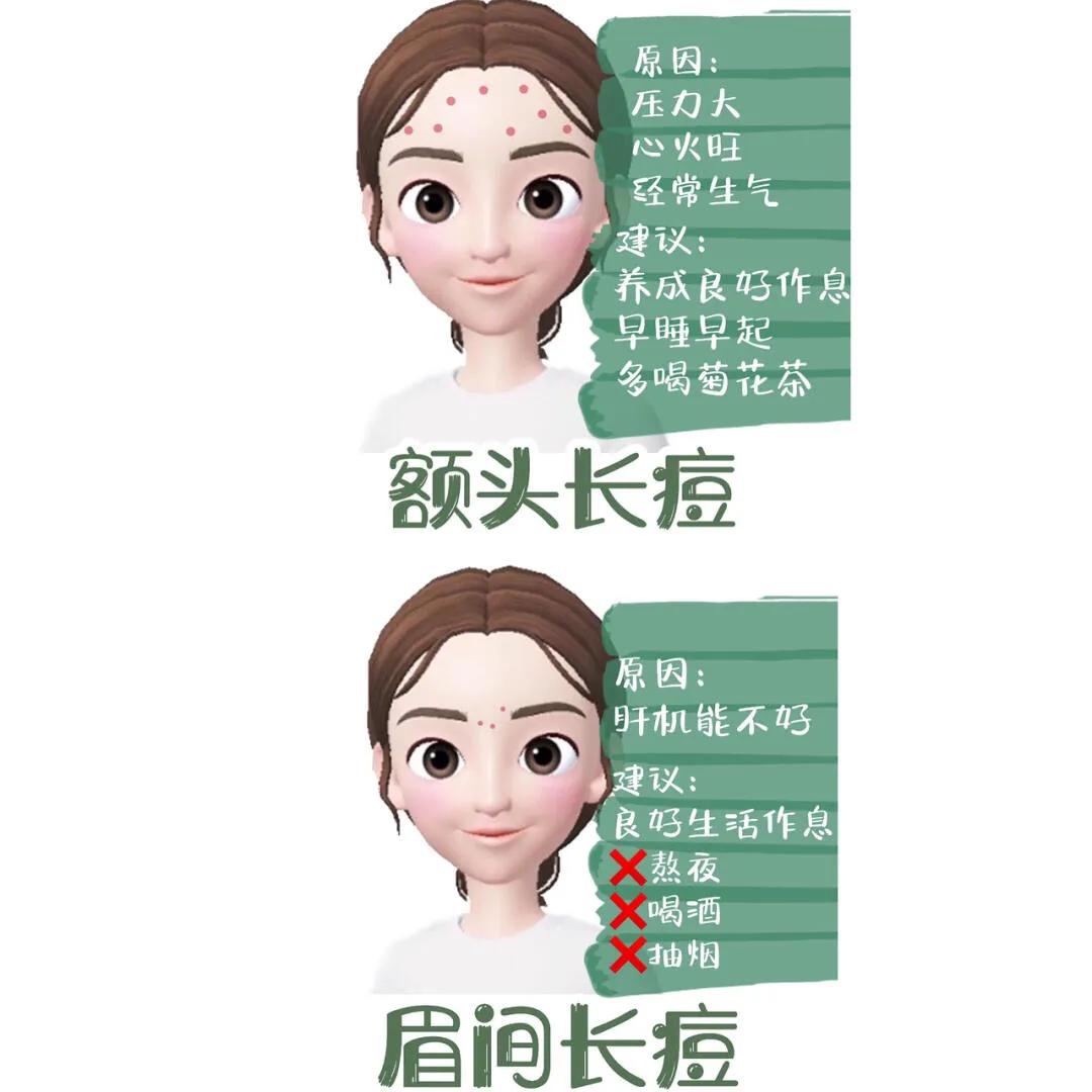 油痘肌大面积痘痘怎么消除,痘痘肌怎么才能不反复长痘