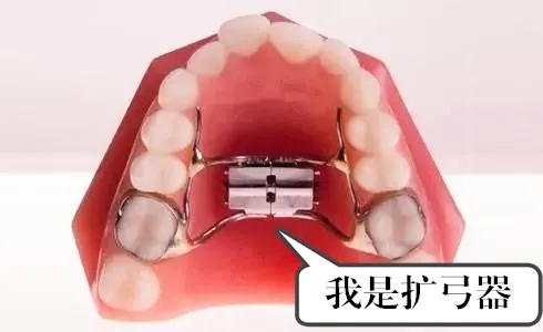 龅牙拥挤矫正需要拔牙吗,牙齿拥挤要拔智齿吗